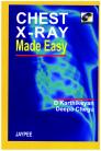 Chest X-Ray Made Easy