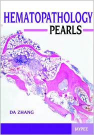 Hematopathology Pearls