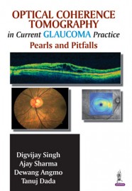 Optical Coherence Tomography in Current Glaucoma Practice 
Pearls and Pitfalls