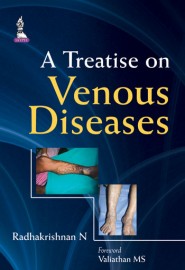 A Treatise on Venous Diseases