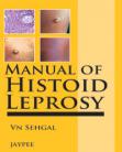 Manual of Histoid Leprosy