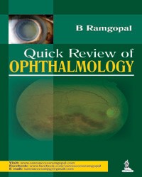 Quick Review of Ophthalmology